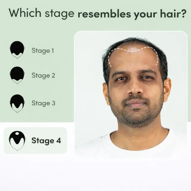 Regrow 10% – Advanced Hair Regrowth Spray for Thinning Hair