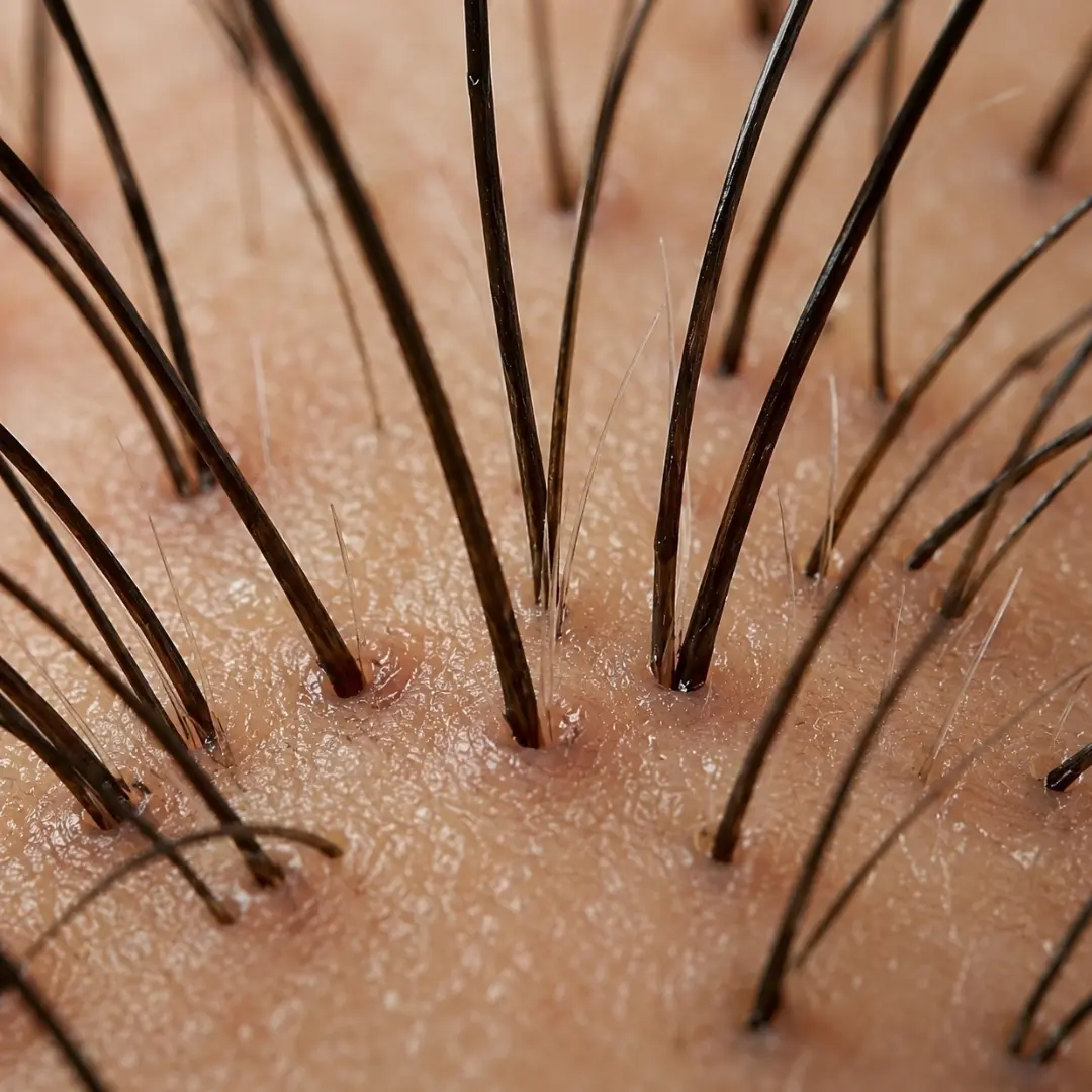 Supports Hair Follicle Care