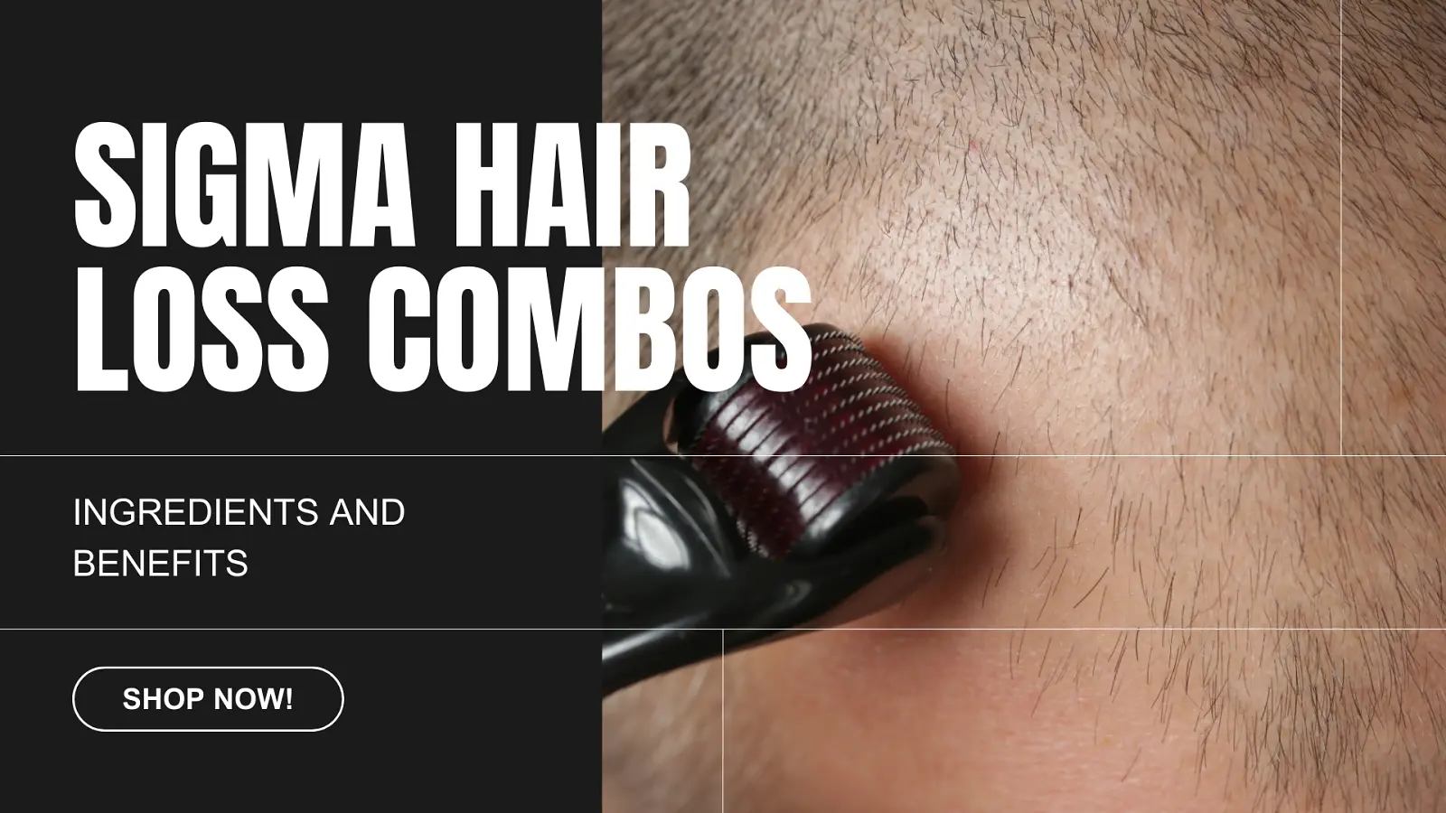 The Science Behind Sigma Guys's Hair Loss Combos: Ingredients &amp; Benefits